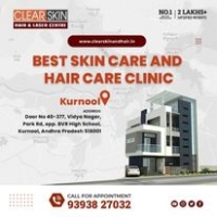 clear skin in kurnool || Top dermatologist in Kurnool